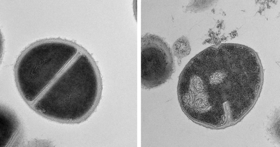 Bactérias Staphylococcus, a saudável à esquerda e outra sendo destruída por antimicrobianos produzidos pelo proteassoma. Foto: Instituto de Ciências Weizmann