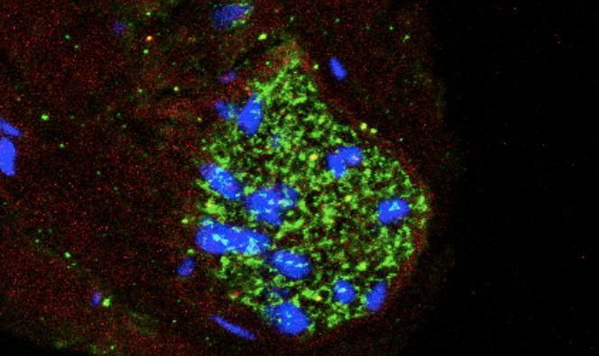 Estrutura que controla a pressão arterial também age como radar de inflamação
